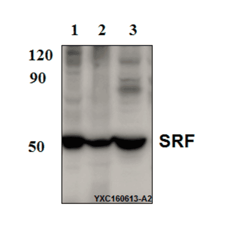 Anti-SRF (N153) Antibody from Bioworld Technology (BS9121) - Antibodies.com