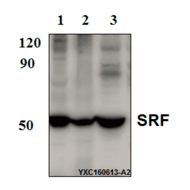 Anti-SRF (N153) Antibody from Bioworld Technology (BS9121) - Antibodies.com