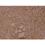 Anti-SRF (N153) Antibody from Bioworld Technology (BS9121) - Antibodies.com
