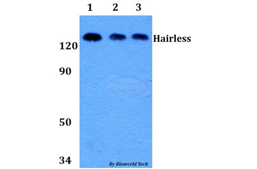Anti-Hairless (E77) Antibody from Bioworld Technology (BS9123) - Antibodies.com