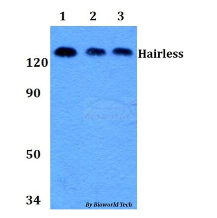 Anti-Hairless (E77) Antibody from Bioworld Technology (BS9123) - Antibodies.com