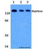 Anti-Hairless (E77) Antibody from Bioworld Technology (BS9123) - Antibodies.com