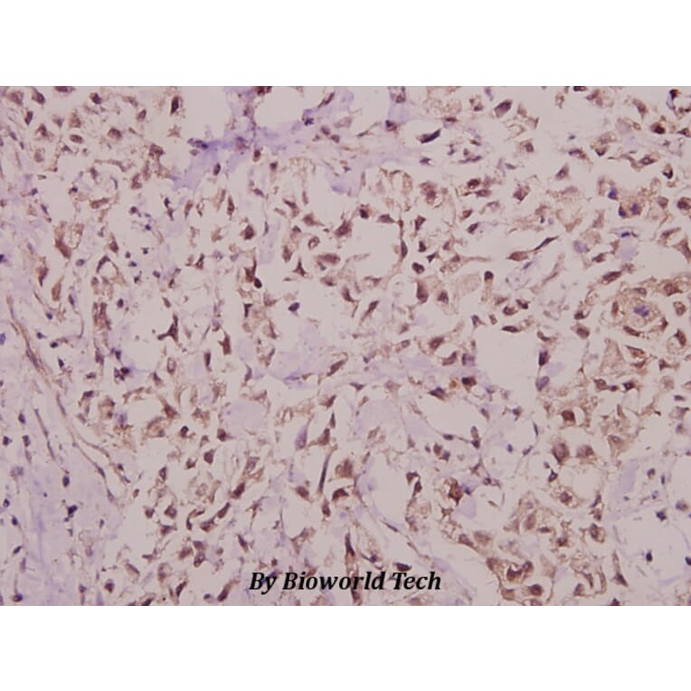 Anti-Hairless (E77) Antibody from Bioworld Technology (BS9123) - Antibodies.com