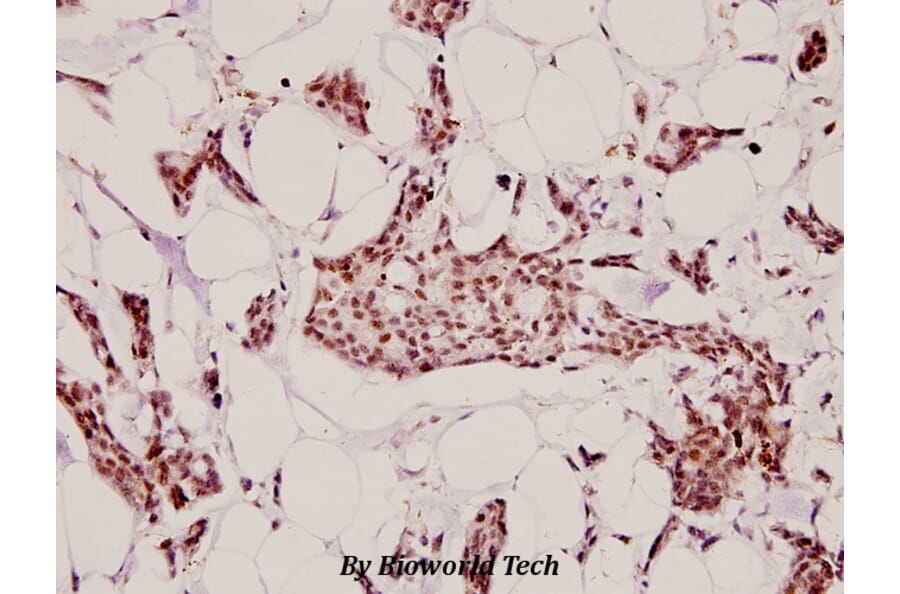 Anti-HC-II (D68) Antibody from Bioworld Technology (BS9125) - Antibodies.com