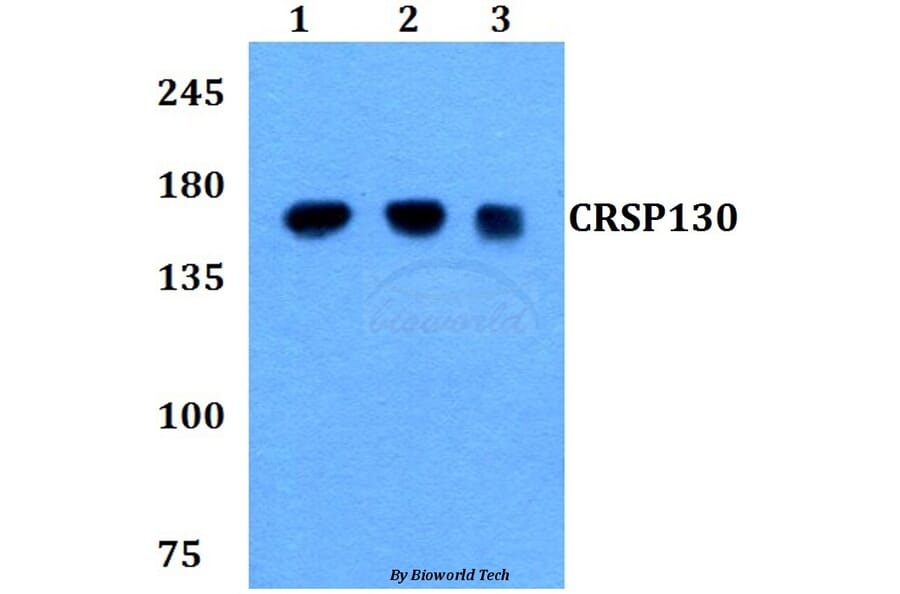 Anti-CRSP130 (F26) Antibody from Bioworld Technology (BS9128) - Antibodies.com