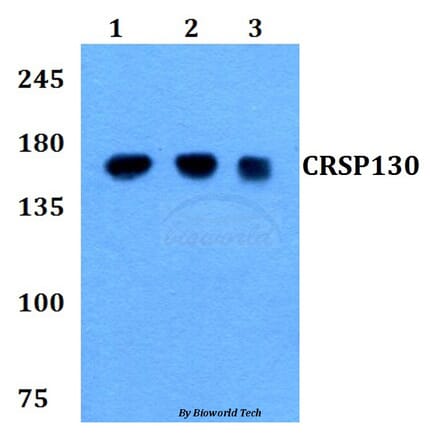 Anti-CRSP130 (F26) Antibody from Bioworld Technology (BS9128) - Antibodies.com