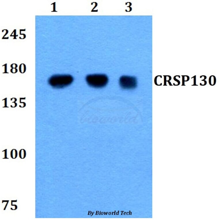 Anti-CRSP130 (F26) Antibody from Bioworld Technology (BS9128) - Antibodies.com