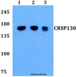 Anti-CRSP130 (F26) Antibody from Bioworld Technology (BS9128) - Antibodies.com