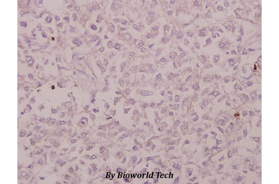 Anti-CRSP130 (F26) Antibody from Bioworld Technology (BS9128) - Antibodies.com