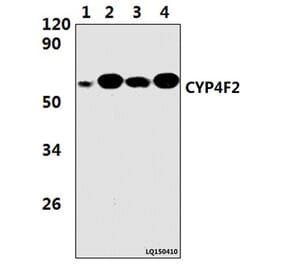 Anti-CYP4F2 (M66) Antibody from Bioworld Technology (BS9135) - Antibodies.com