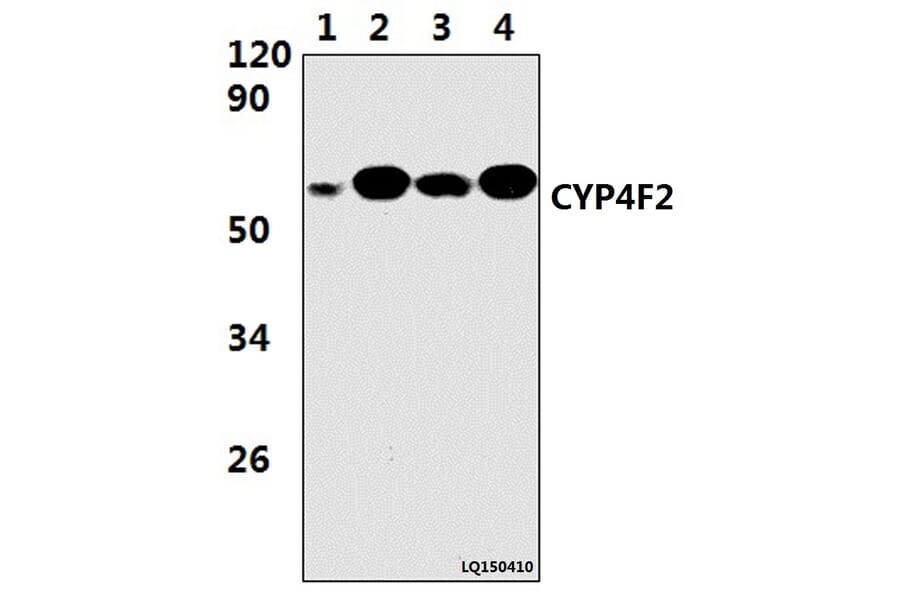Anti-CYP4F2 (M66) Antibody from Bioworld Technology (BS9135) - Antibodies.com