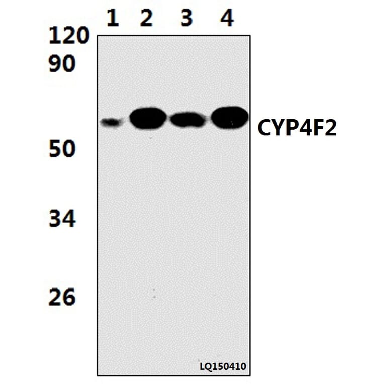 Anti-CYP4F2 (M66) Antibody from Bioworld Technology (BS9135) - Antibodies.com