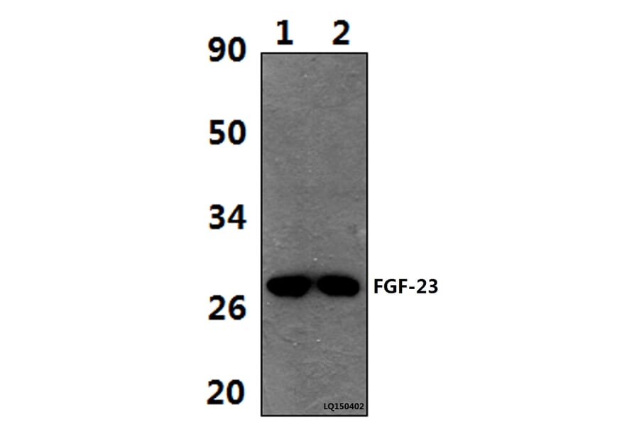 Anti-FGF-23 (A181) Antibody from Bioworld Technology (BS9136) - Antibodies.com