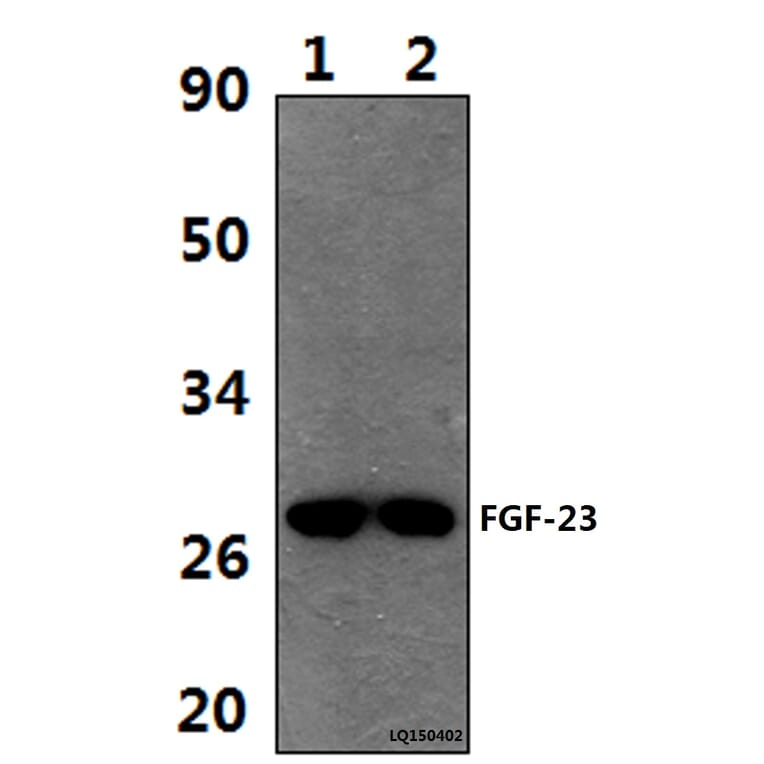 Anti-FGF-23 (A181) Antibody from Bioworld Technology (BS9136) - Antibodies.com