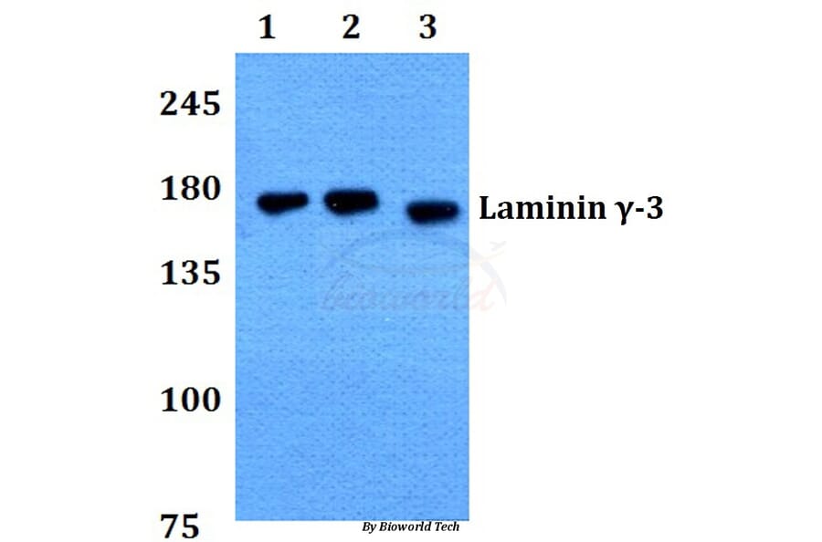 Anti-Laminin γ-3 (T1385) Antibody from Bioworld Technology (BS9139) - Antibodies.com