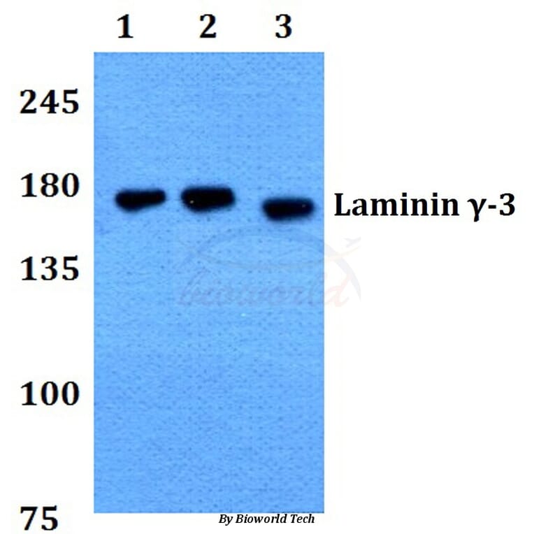 Anti-Laminin γ-3 (T1385) Antibody from Bioworld Technology (BS9139) - Antibodies.com