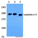 Anti-Laminin γ-3 (T1385) Antibody from Bioworld Technology (BS9139) - Antibodies.com