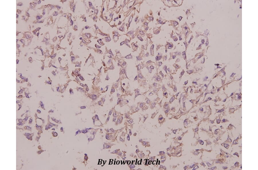 Anti-Laminin γ-3 (T1385) Antibody from Bioworld Technology (BS9139) - Antibodies.com
