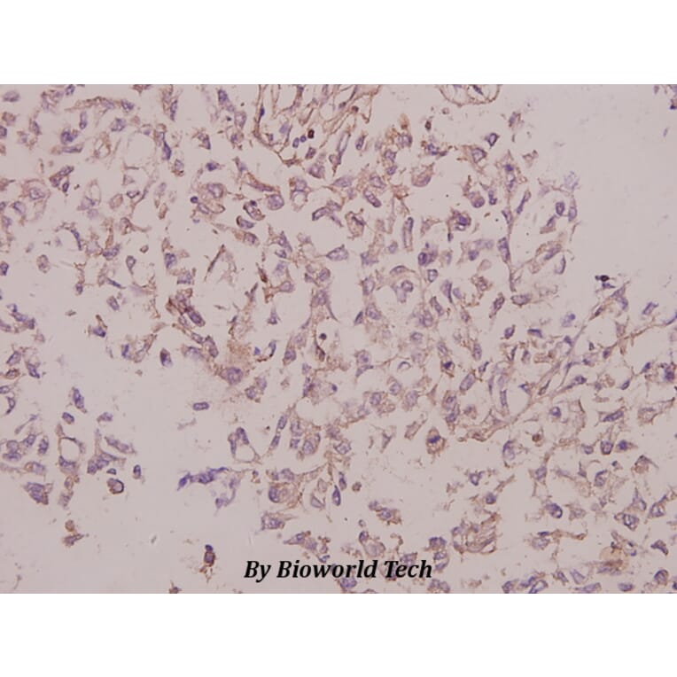 Anti-Laminin γ-3 (T1385) Antibody from Bioworld Technology (BS9139) - Antibodies.com
