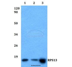 Anti-RPS13 (L115) Antibody from Bioworld Technology (BS9142) - Antibodies.com