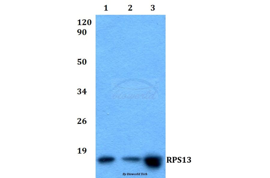 Anti-RPS13 (L115) Antibody from Bioworld Technology (BS9142) - Antibodies.com