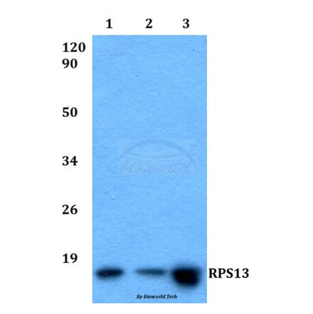 Anti-RPS13 (L115) Antibody from Bioworld Technology (BS9142) - Antibodies.com