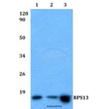 Anti-RPS13 (L115) Antibody from Bioworld Technology (BS9142) - Antibodies.com