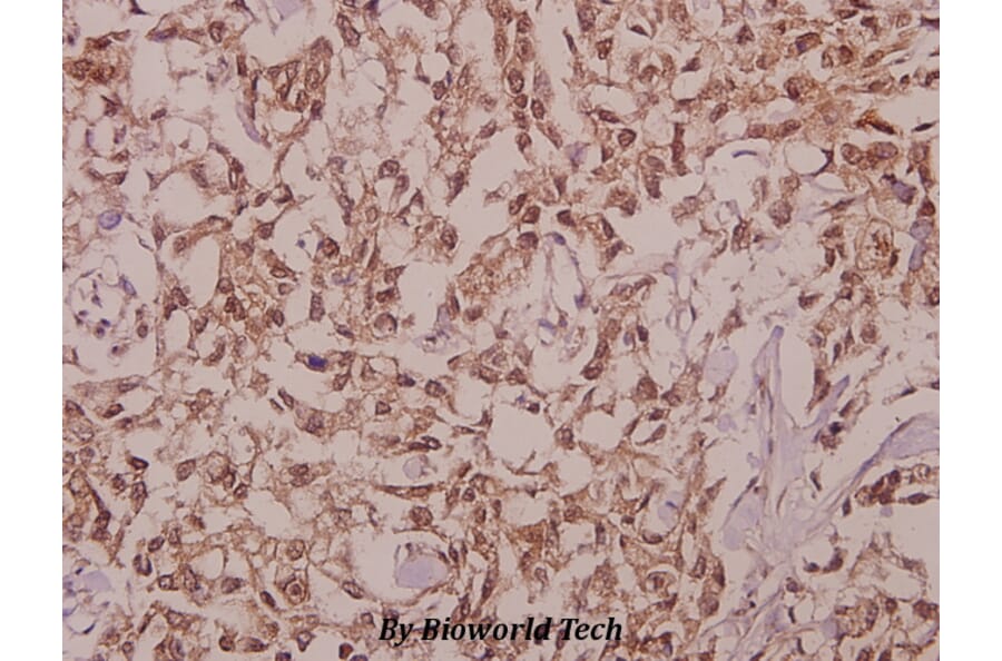 Anti-DDX19B (V38) Antibody from Bioworld Technology (BS9143) - Antibodies.com