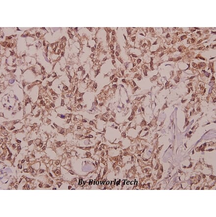 Anti-DDX19B (V38) Antibody from Bioworld Technology (BS9143) - Antibodies.com