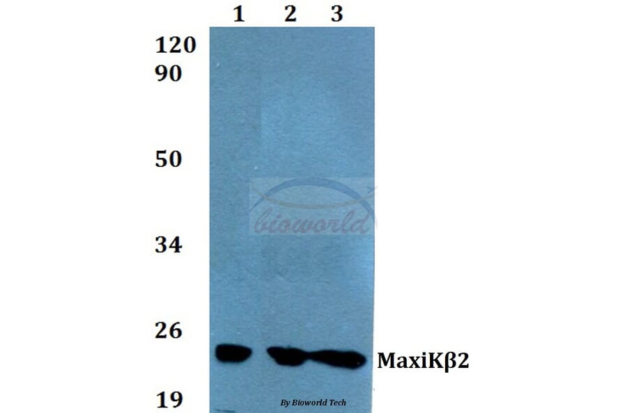 Anti-MaxiKβ2 (I186) Antibody from Bioworld Technology (BS9144) - Antibodies.com