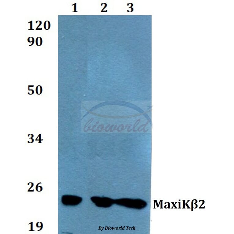 Anti-MaxiKβ2 (I186) Antibody from Bioworld Technology (BS9144) - Antibodies.com