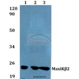 Anti-MaxiKβ2 (I186) Antibody from Bioworld Technology (BS9144) - Antibodies.com