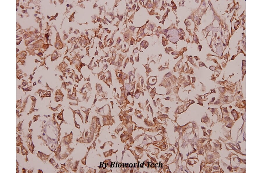 Anti-MaxiKβ2 (I186) Antibody from Bioworld Technology (BS9144) - Antibodies.com