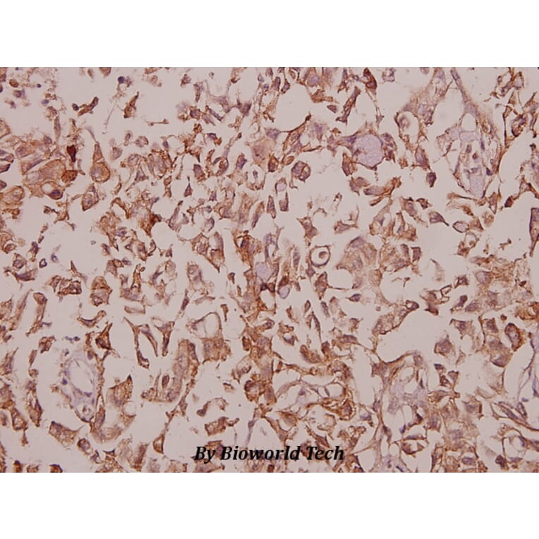 Anti-MaxiKβ2 (I186) Antibody from Bioworld Technology (BS9144) - Antibodies.com