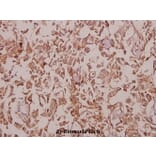 Anti-MaxiKβ2 (I186) Antibody from Bioworld Technology (BS9144) - Antibodies.com