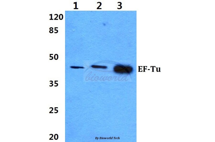 Anti-EF-Tu (L338) Antibody from Bioworld Technology (BS9146) - Antibodies.com