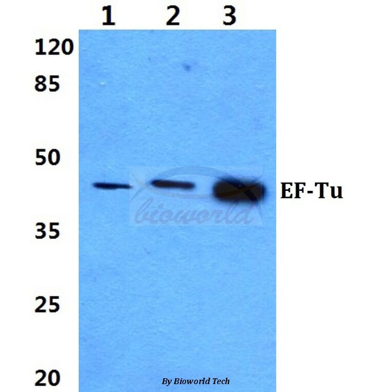 Anti-EF-Tu (L338) Antibody from Bioworld Technology (BS9146) - Antibodies.com