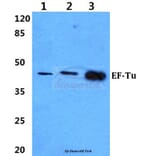 Anti-EF-Tu (L338) Antibody from Bioworld Technology (BS9146) - Antibodies.com