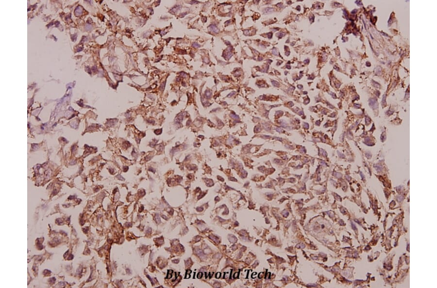 Anti-NDUFB9 (E134) Antibody from Bioworld Technology (BS9153) - Antibodies.com