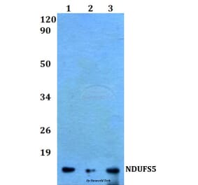 Anti-NDUFS5 (E89) Antibody from Bioworld Technology (BS9154) - Antibodies.com
