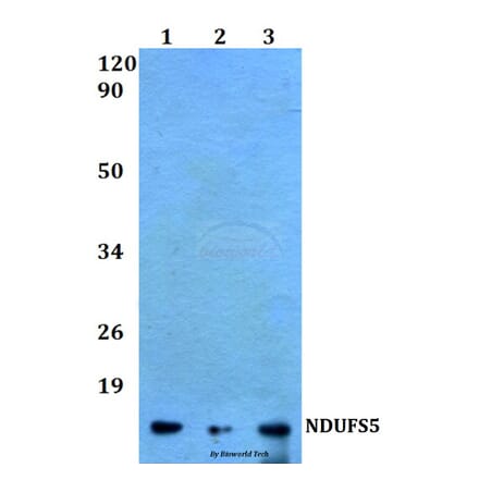 Anti-NDUFS5 (E89) Antibody from Bioworld Technology (BS9154) - Antibodies.com