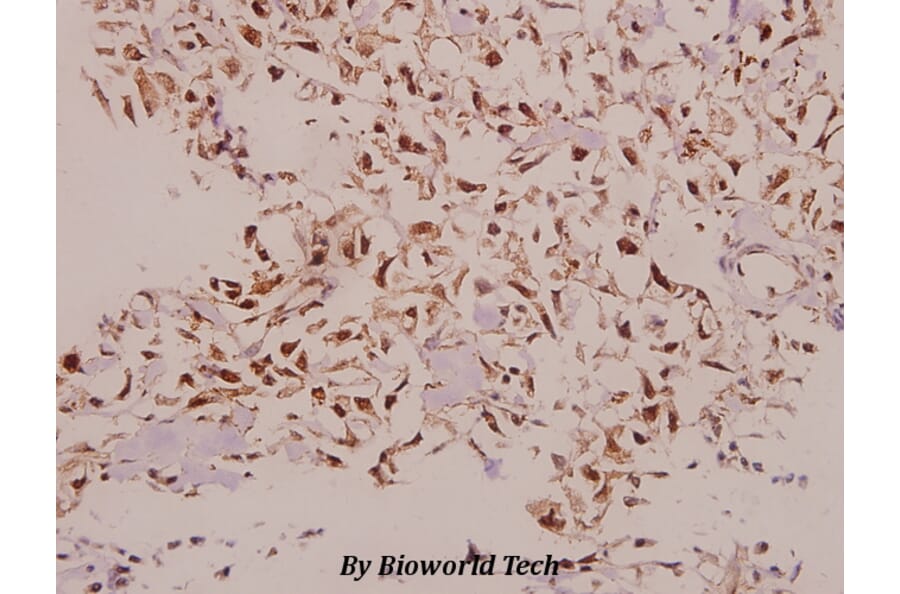 Anti-NDUFS5 (E89) Antibody from Bioworld Technology (BS9154) - Antibodies.com