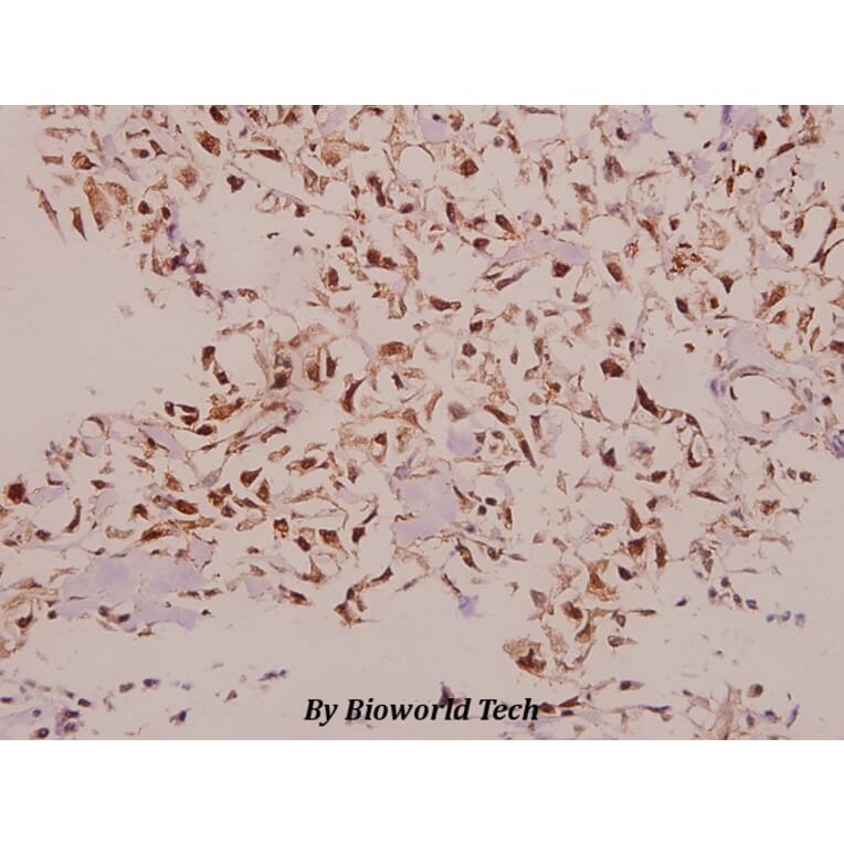 Anti-NDUFS5 (E89) Antibody from Bioworld Technology (BS9154) - Antibodies.com