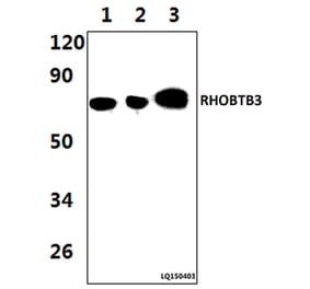 Anti-RHOBTB3 (L365) Antibody from Bioworld Technology (BS9159) - Antibodies.com