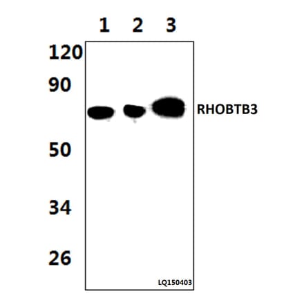 Anti-RHOBTB3 (L365) Antibody from Bioworld Technology (BS9159) - Antibodies.com