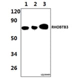 Anti-RHOBTB3 (L365) Antibody from Bioworld Technology (BS9159) - Antibodies.com