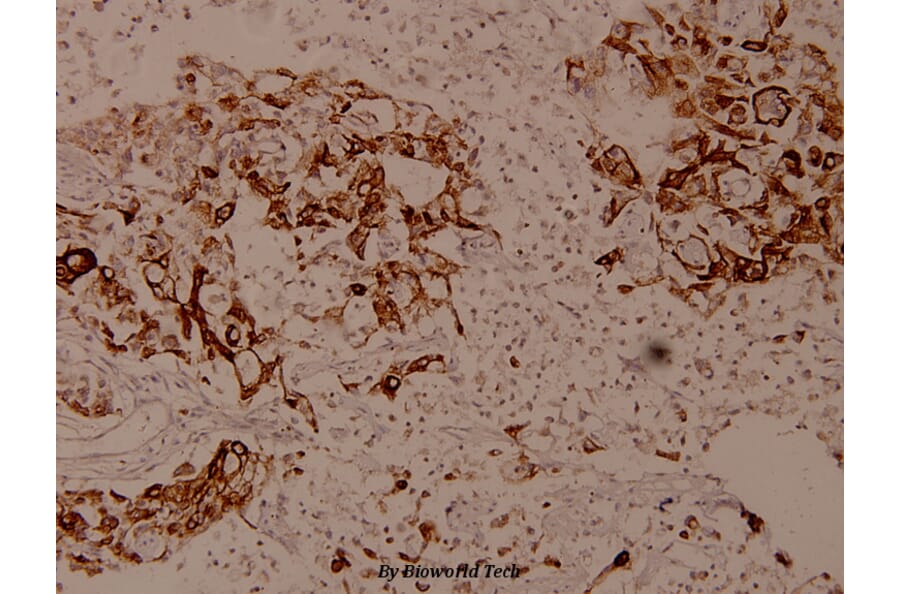 Anti-LEKTI (H525) Antibody from Bioworld Technology (BS9160) - Antibodies.com