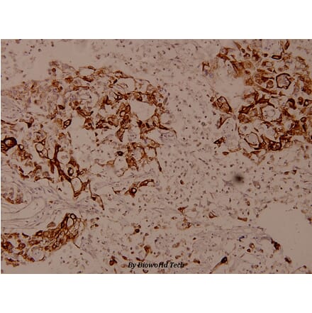 Anti-LEKTI (H525) Antibody from Bioworld Technology (BS9160) - Antibodies.com