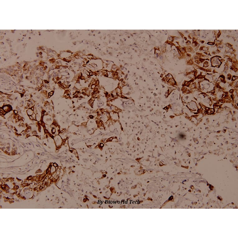 Anti-LEKTI (H525) Antibody from Bioworld Technology (BS9160) - Antibodies.com