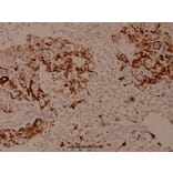 Anti-LEKTI (H525) Antibody from Bioworld Technology (BS9160) - Antibodies.com